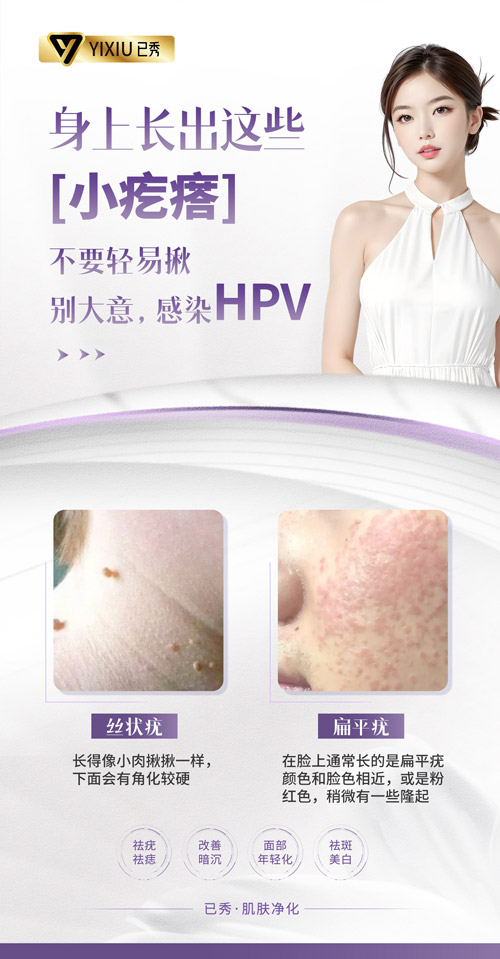 三千家减肥瘦身总部 阳泉哪里减肥效果好