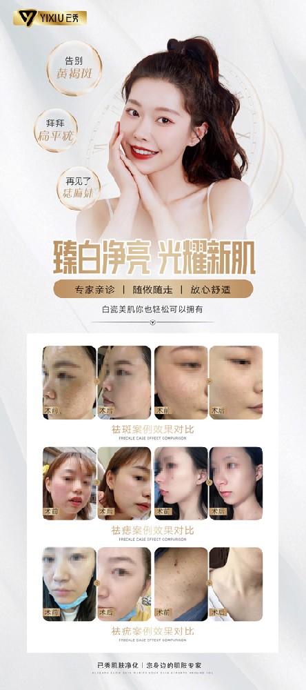 想开合作三千家减肥店 瘦身店加盟品牌